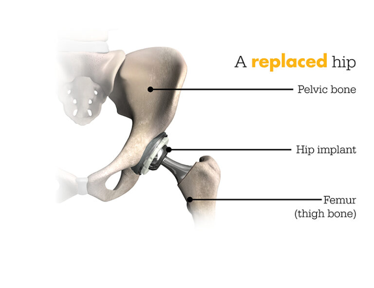 Hip Doctors Houston | Catherine Cahill MD