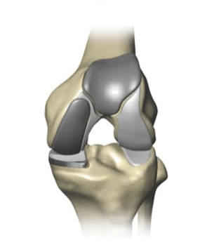 Knee Doctor Houston | Catherine Cahill MD